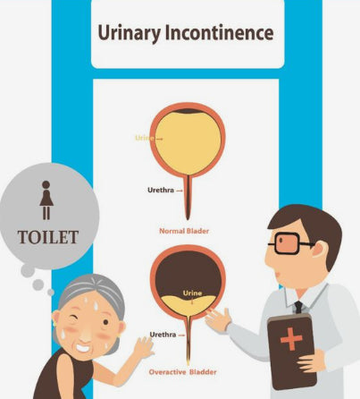 The Ultimate Guide to Managing Incontinence with Confidence - Trendix